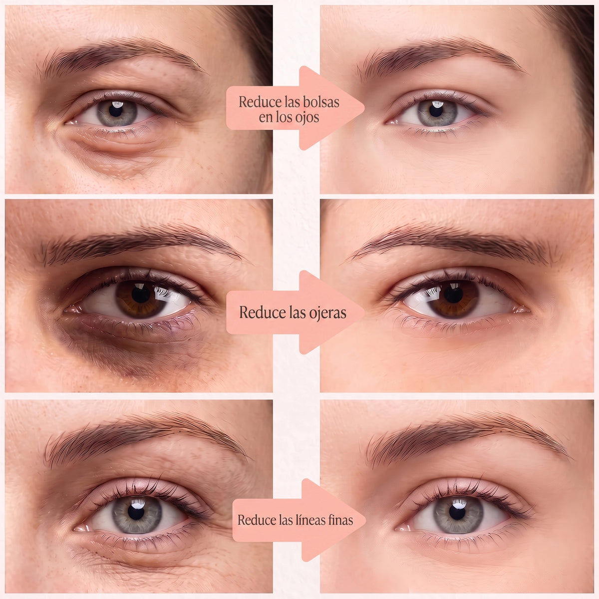 Parches de luz roja para bolsas en los ojos y ojeras