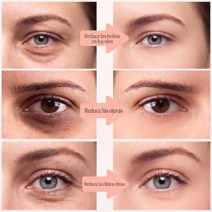 Parches de luz roja para bolsas en los ojos y ojeras